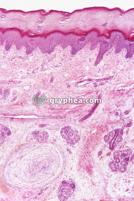 CT Peau_Pacini x25 - gryphea.org